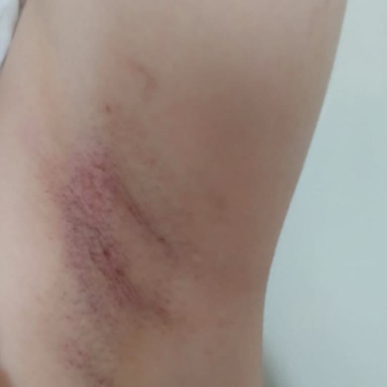 Vina Güzellik (Gaziantep) Sözünde Durmadı ve Koltuk altımı yaktı