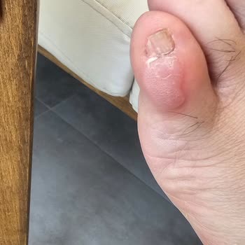 Ayakkabı Sorunu Çözülmedi, İade Talebim Reddedildi!