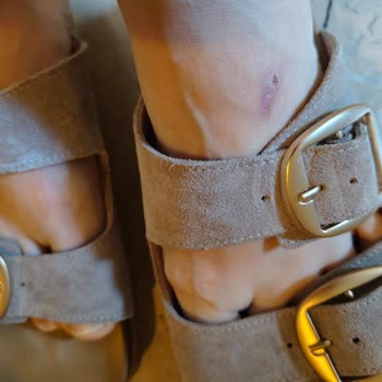 Derimod Terlik Tasarım Hatası Nedeniyle Yara Açtı, Değişim Ve İade Reddedildi