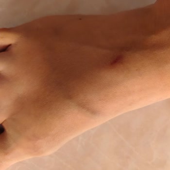 Derimod Terlik Tasarım Hatası Nedeniyle Yara Açtı, Değişim Ve İade Reddedildi