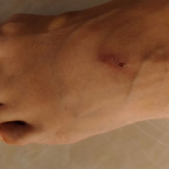 Derimod Terlik Tasarım Hatası Nedeniyle Yara Açtı, Değişim Ve İade Reddedildi