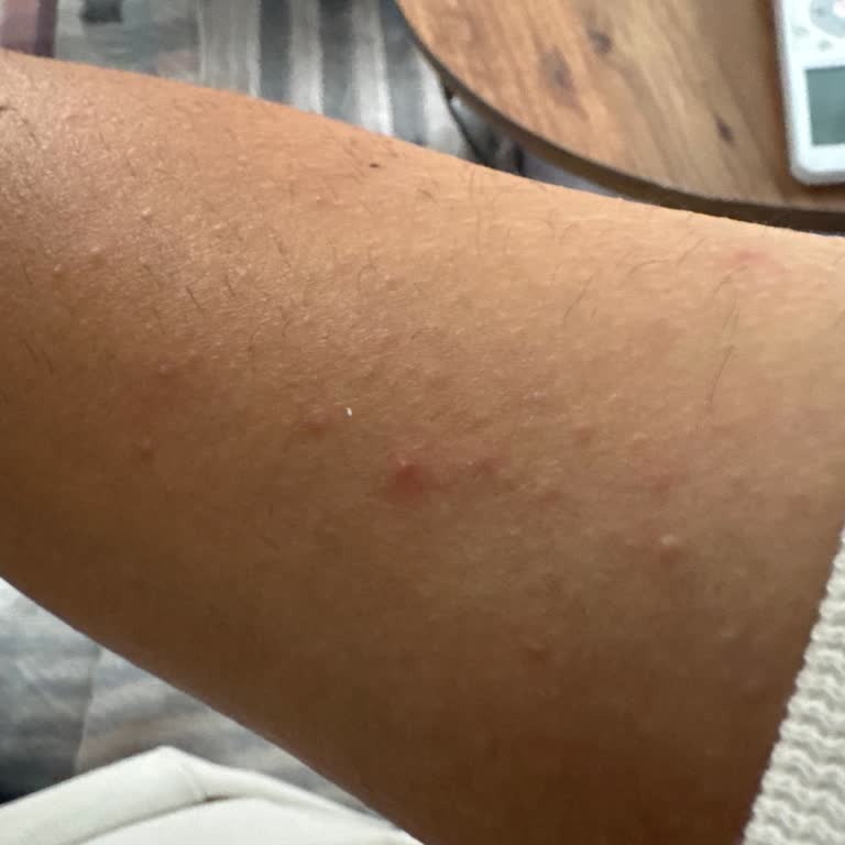 Epify Aldığım Tüy Dökücü Krem Etkili Olmadı Ve Cilt Sorunları Yaşadım