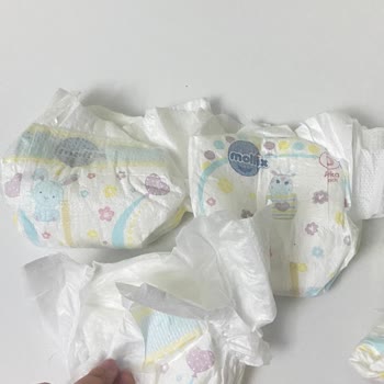 Prematüre Bebek Bezlerinde Cırt Cırt Sorunu Mağduriyet Yaşatıyor