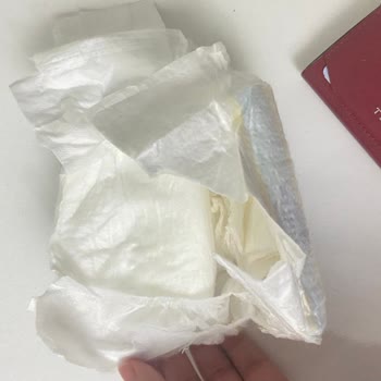 Prematüre Bebek Bezlerinde Cırt Cırt Sorunu Mağduriyet Yaşatıyor