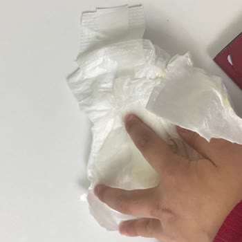 Prematüre Bebek Bezlerinde Cırt Cırt Sorunu Mağduriyet Yaşatıyor