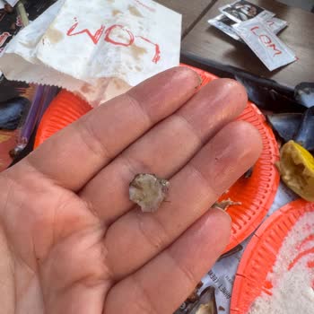 Midyeden Taş Çıktı, Hijyen Sorunu Var!