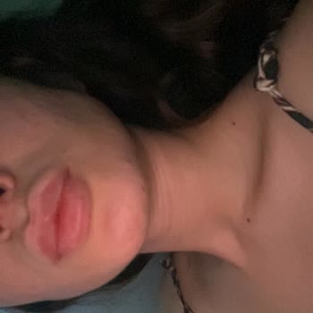 Cosmetolog Aleyna Dudağımı Mahvetti