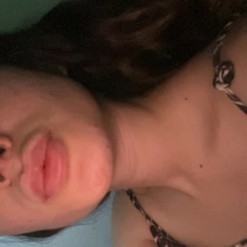 Cosmetolog Aleyna Dudağımı Mahvetti