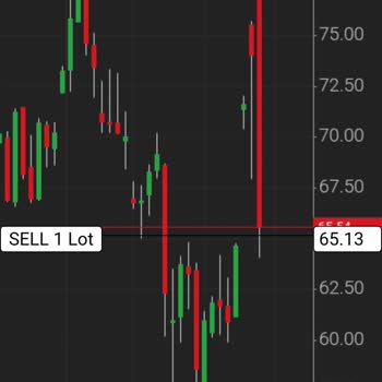 Xm.com Platformunda Yatırım Kaybı ve Destek Sorunları