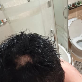 Hairplus Pişmanlığı