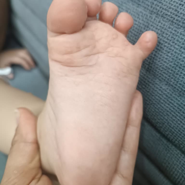 Otelde Temizlik Eksikliği Nedeniyle Çocuklarım Hastalandı