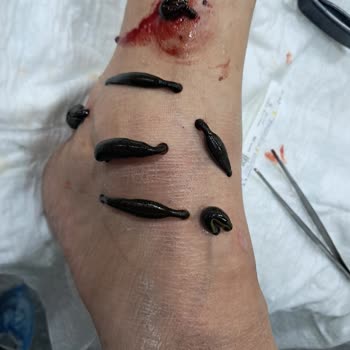 Uzm. Dr. Firdevs Güçer Tedavi Sonrası İlgisizlik ve Enfeksiyon Nedeniyle Mağduriyet Yaşadım