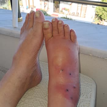 Uzm. Dr. Firdevs Güçer Tedavi Sonrası İlgisizlik ve Enfeksiyon Nedeniyle Mağduriyet Yaşadım