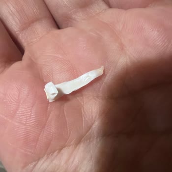 File Market Dondurmadan Çıkan Plastik Parça Çocuğumun Sağlığını Tehlikeye Attı