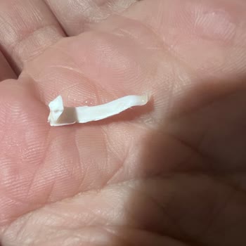 File Market Dondurmadan Çıkan Plastik Parça Çocuğumun Sağlığını Tehlikeye Attı