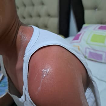 Nivea 50 Faktör Çocuk Güneş Kremi Güneş Yanıklarını Önlemedi