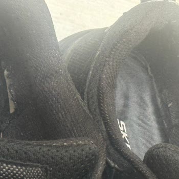 Skechers Ayakkabım 1 Ayda Yırtıldı Kullanıcı Hatası Denildi