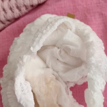 Bebek Bezinden Tel Çıkması Ve Güvenlik Endişesi