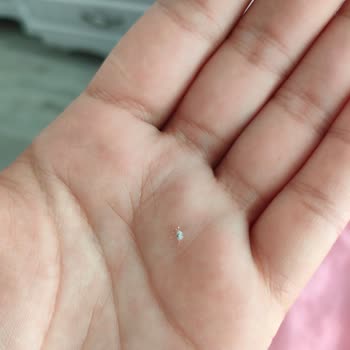 Bebek Bezinden Tel Çıkması Ve Güvenlik Endişesi