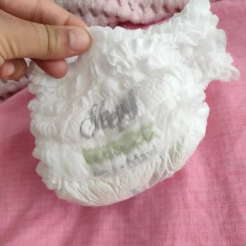 Bebek Bezinden Tel Çıkması Ve Güvenlik Endişesi