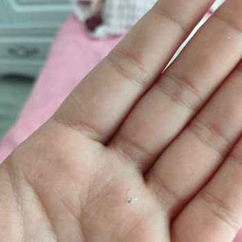 Bebek Bezinden Tel Çıkması Ve Güvenlik Endişesi