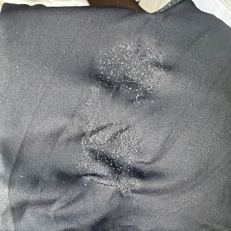 Suwen Ürünü Deforme Oldu, Müşteri Hizmetleri Destek Sağlamadı