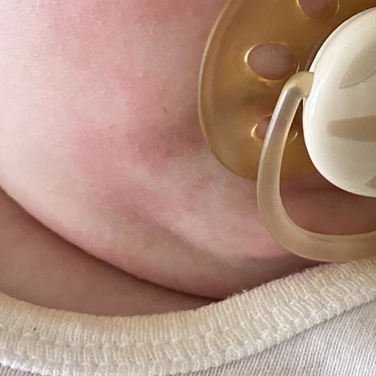 Bebek Ürününden Sonra Cildinde Şiddetli Tahriş Ve Alerji Oluştu