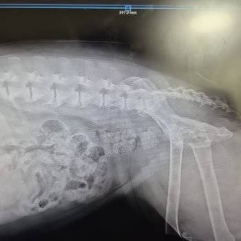 Yanlış Teşhis Ve Eksik Tedaviyle Zaman Kaybı Yaşadık