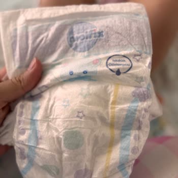 Molfix Bebek Bezinde Bacaklarda İz Ve Yara Oluşumu