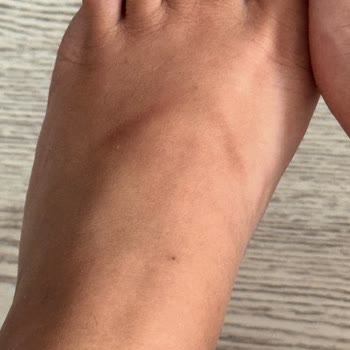 Kısa Sürede Yaraya Sebep Olan Terlik Hayal Kırıklığı Yarattı