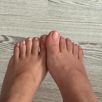 Kısa Sürede Yaraya Sebep Olan Terlik Hayal Kırıklığı Yarattı