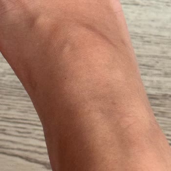 Kısa Sürede Yaraya Sebep Olan Terlik Hayal Kırıklığı Yarattı