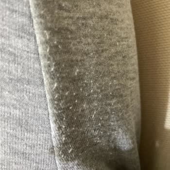 Yeni Alınan Eşofmanın Hızla Tüylenmesi Hayal Kırıklığı Yarattı