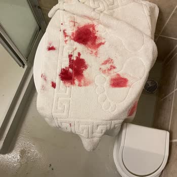 Otel Odasında Yaşanan Kaza Sonrası İlgisiz Ve Sorumluluk Almayan Yönetim Nedeniyle Tatilimiz Mahvoldu