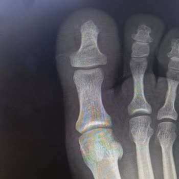 Otel Odasında Yaşanan Kaza Sonrası İlgisiz Ve Sorumluluk Almayan Yönetim Nedeniyle Tatilimiz Mahvoldu