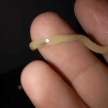 İndomie Noodle'da Yabancı Madde Ve Müşteri Hizmetleri Sorunu