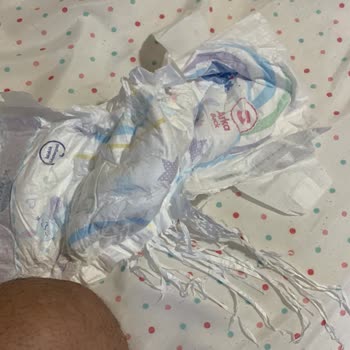 Molfix Bebek Bezinde Kalite Kontrol Eksikliği Mağduriyet Yarattı