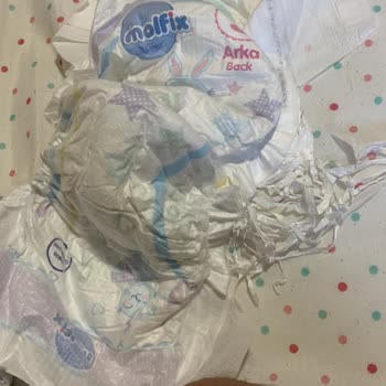 Molfix Bebek Bezinde Kalite Kontrol Eksikliği Mağduriyet Yarattı