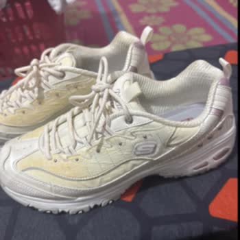 Kısa Sürede Sararan Ayakkabı İçin Olumsuz Skechers Deneyimi