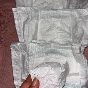 Molfix Bebek Bezlerinde Bant Eksikliği Sorunu