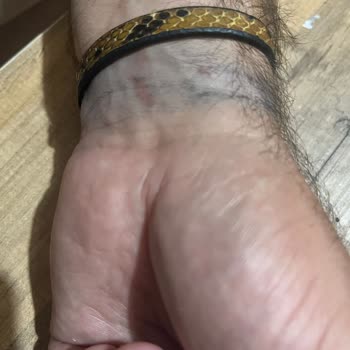 Hediye Takıların Kalitesizliği Nedeniyle Mağduriyet Yaşıyorum