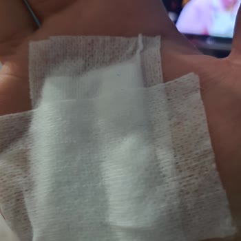 Kulaksız Mezarlığında Köpek Saldırısı Ve Önlem Eksikliği