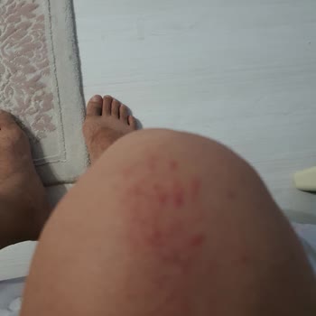 Kulaksız Mezarlığında Köpek Saldırısı Ve Önlem Eksikliği