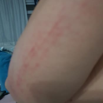 Kulaksız Mezarlığında Köpek Saldırısı Ve Önlem Eksikliği