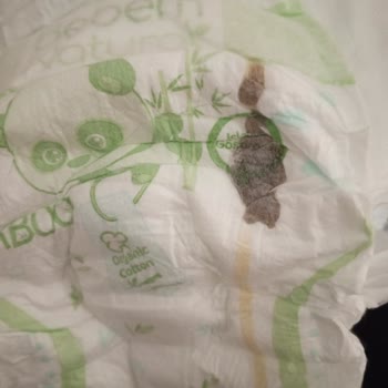 Bebek Bezinde Karşılaştığım Belirsiz Madde Endişesi