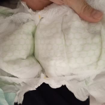 Bebek Bezinde Karşılaştığım Belirsiz Madde Endişesi