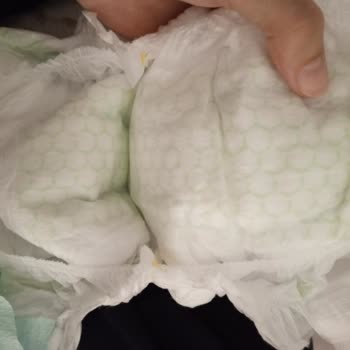 Bebek Bezinde Karşılaştığım Belirsiz Madde Endişesi