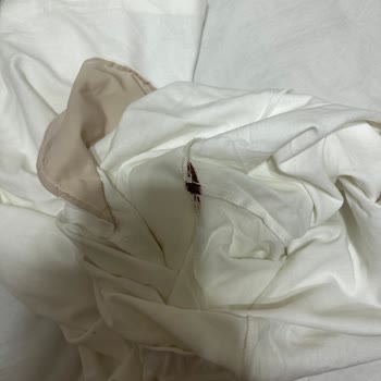 Satın Aldığım Pantolonda Hijyen Sorunu Ve Mağaza Personelinin İlgisizliği