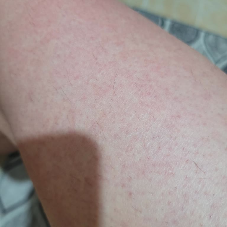 Ürün Kullanımı Sonrası Alerjik Reaksiyon