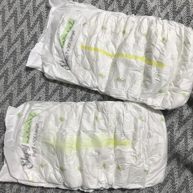 Sleepy Bebek Bezi Kalitesinde Düşüş Ve Kullanım Sorunları